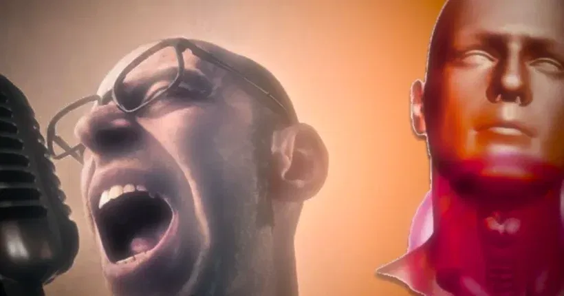 20_polipo alle corde vocali